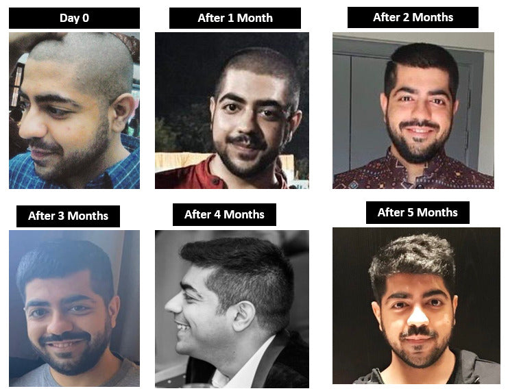 Hair Growth Plus+